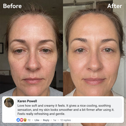 Expert Madeca Cream Active Renew PDRN