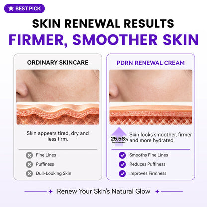 Expert Madeca Cream Active Renew PDRN