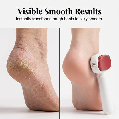 Dual‐Sided Foot Callus Remover, Replaceable Stainless Steel Blade Foot Scraper 🦶