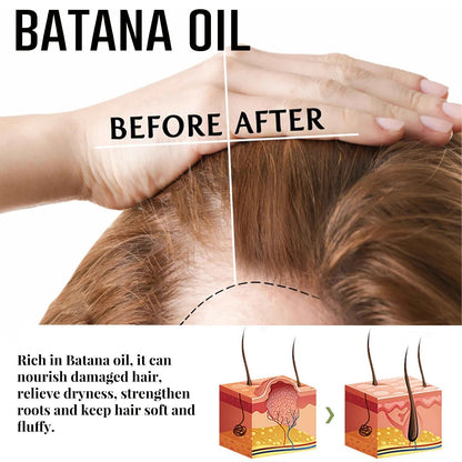 💯【Official Brand Store】- 🌿Natural Herbal Handcrafted Batana Oil Hair Growth Blend