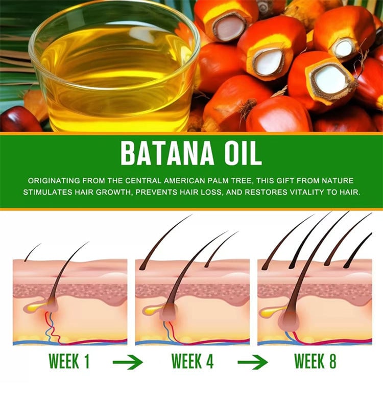 💯【Official Brand Store】- 🌿Natural Herbal Handcrafted Batana Oil Hair Growth Blend