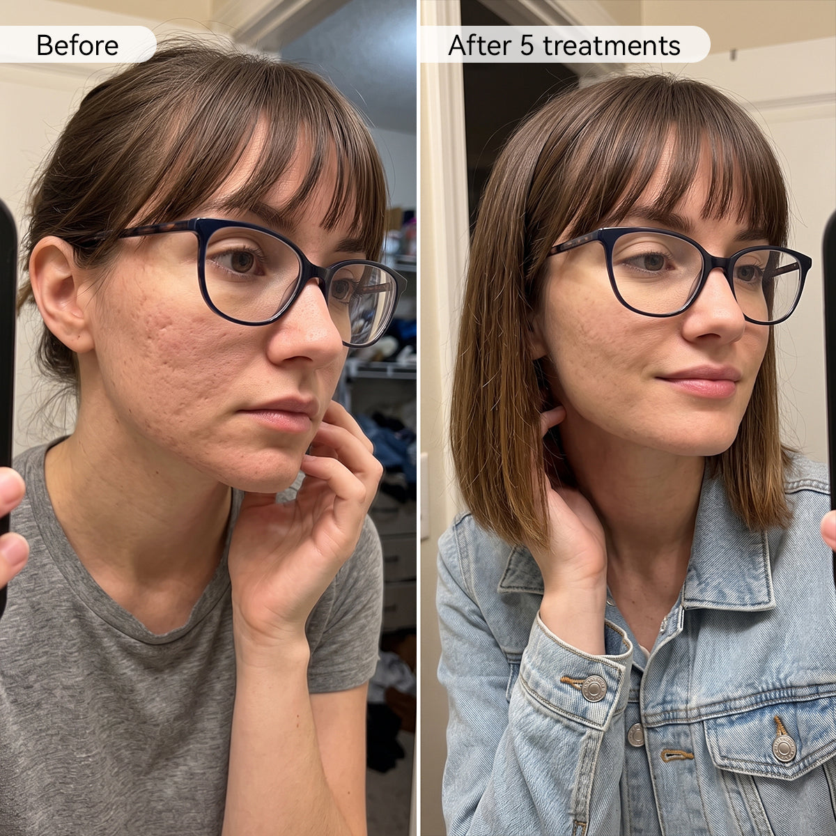 PDRN Advanced Infusion Treatment