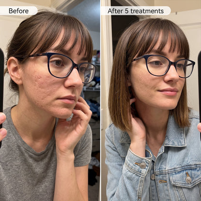 PDRN Advanced Infusion Treatment