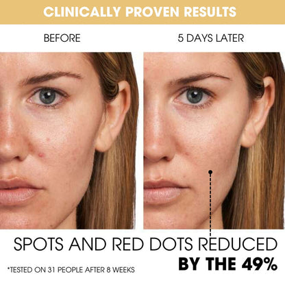Exnotic—Gel With Vitamin C Capsule Cream