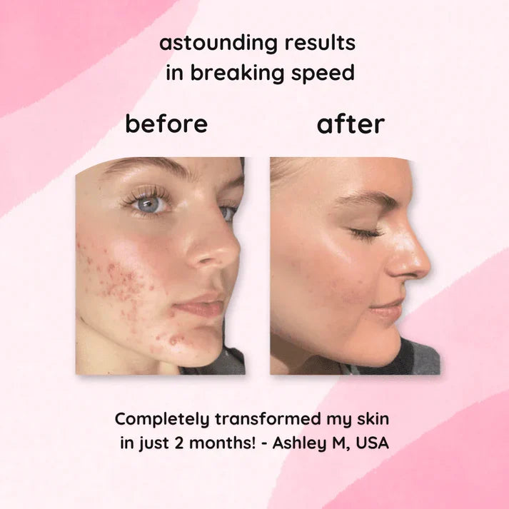 Turmeric Kojic Acid Cleansing Pads