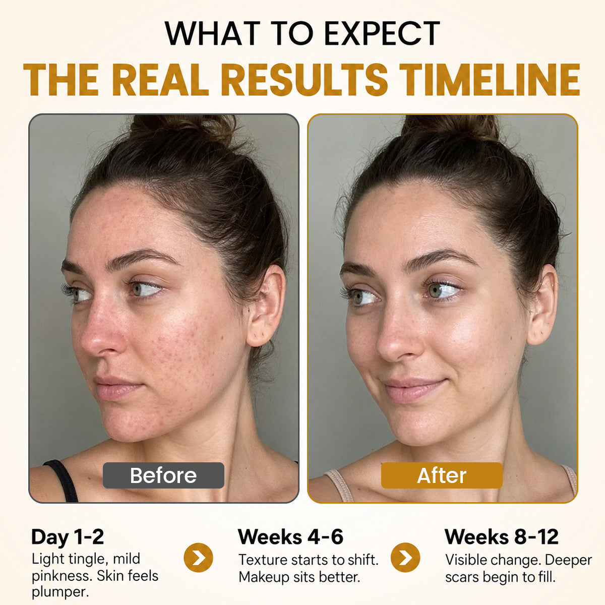 PDRN Advanced Infusion Treatment
