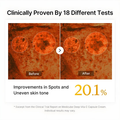 Exnotic—Gel With Vitamin C Capsule Cream