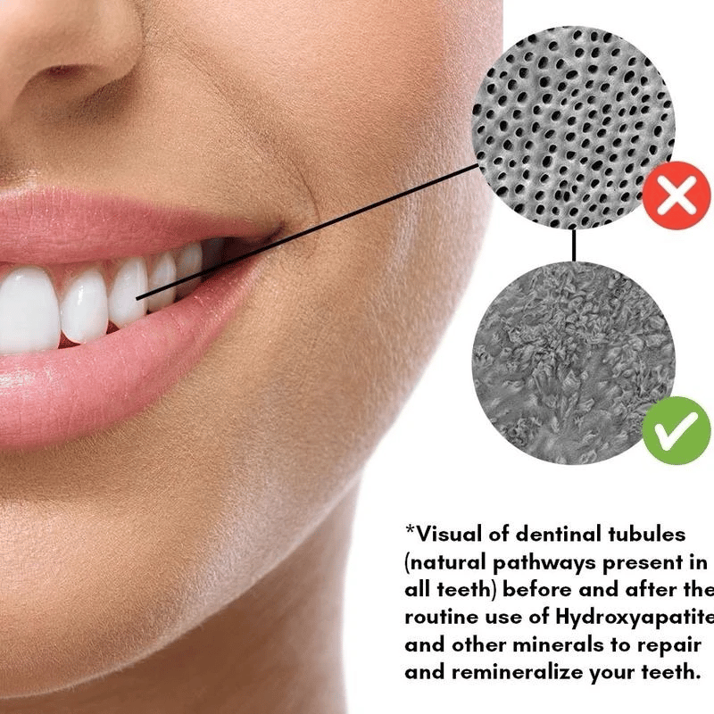 Organic MASTIC MINT remineralizing chewing gum with Nano-hydroxyapatite -kill bacteria, remove plaque & repair enamel