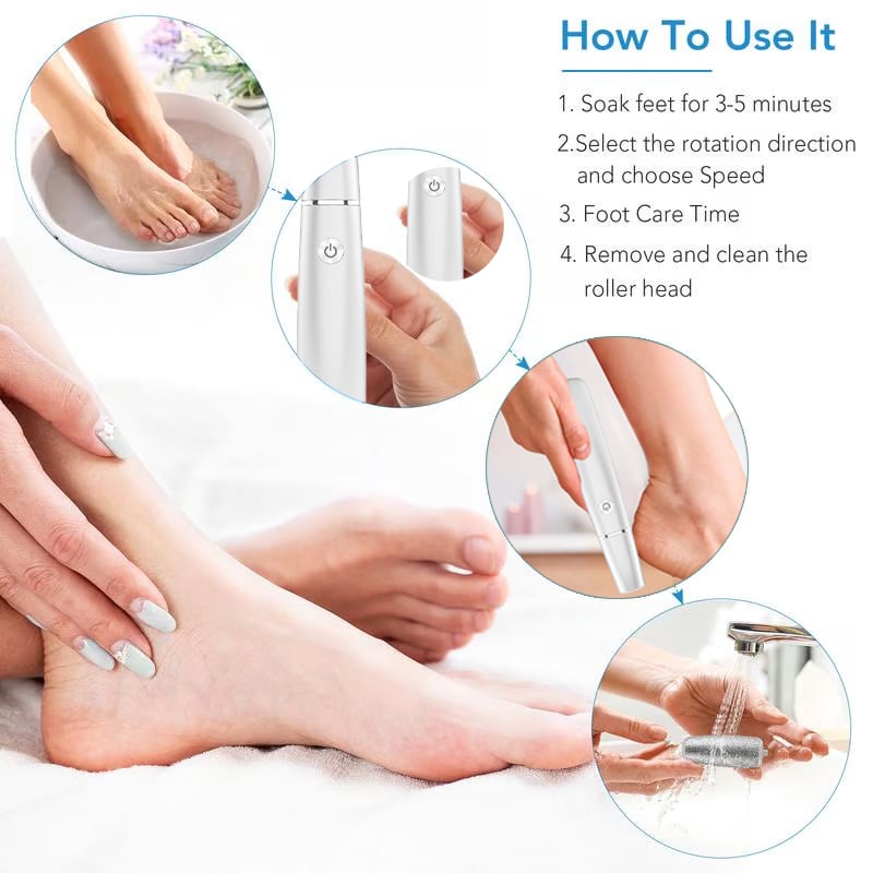 Electric Feet Callus Remover