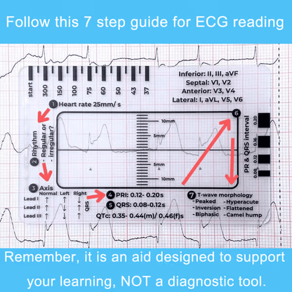 (🔥HOT SALE NOW 60% OFF) -ECG 7 Step Ruler