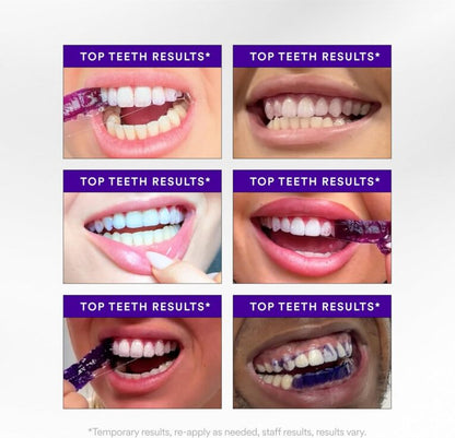 Whitening Strips: ‘’The Fast Track to a Stunning Smile!‘’