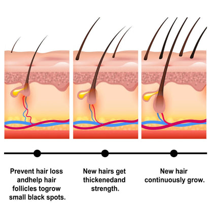 💯【Official Brand Store】- 🌿Natural Herbal Handcrafted Batana Oil Hair Growth Blend