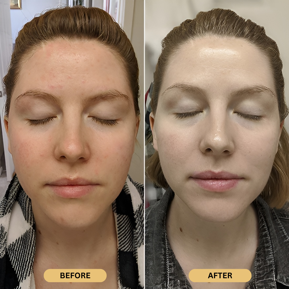 Exnotic—Gel With Vitamin C Capsule Cream