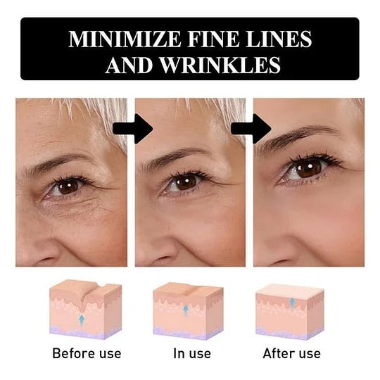 Hyaluronic Acid Anti-Wrinkle Repair Essence