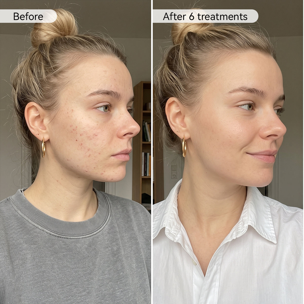 PDRN Advanced Infusion Treatment
