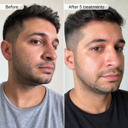 PDRN Advanced Infusion Treatment