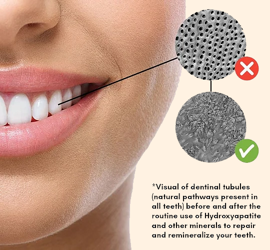 Remineralizing Gum
