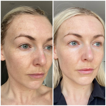 8D Hyaluronic Acid + PDRN Plump Serum
