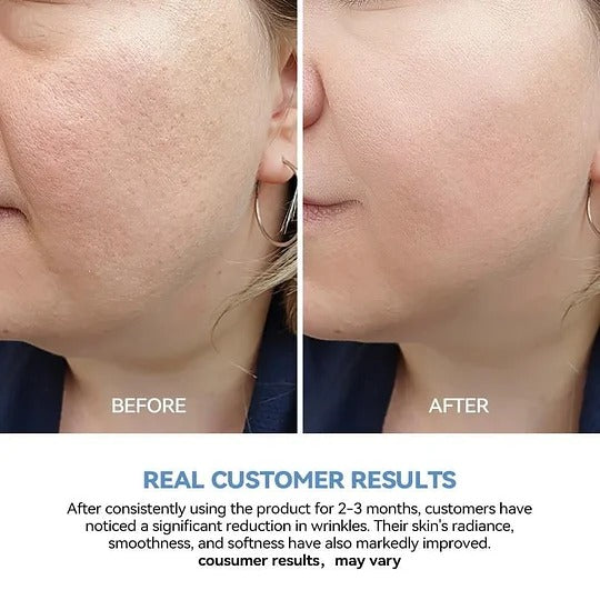 Hyaluronic Acid Anti-Wrinkle Repair Essence