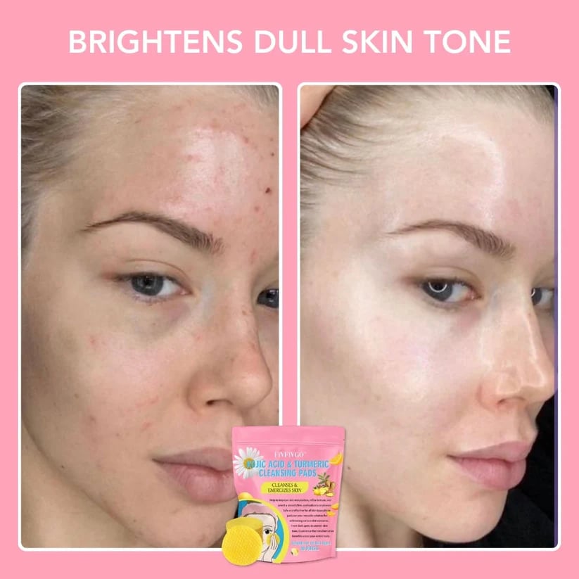 🔥LAST DAY 49% OFF🔥 Turmeric Kojic Acid Cleansing Pads