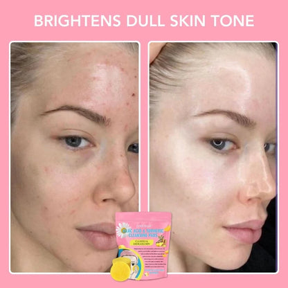 🔥LAST DAY 49% OFF🔥 Turmeric Kojic Acid Cleansing Pads