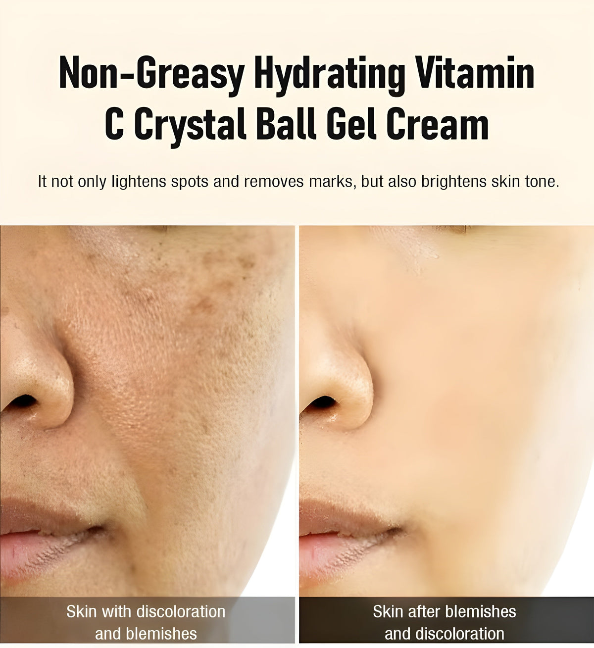 Exnotic—Gel With Vitamin C Capsule Cream