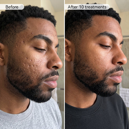 PDRN Advanced Infusion Treatment